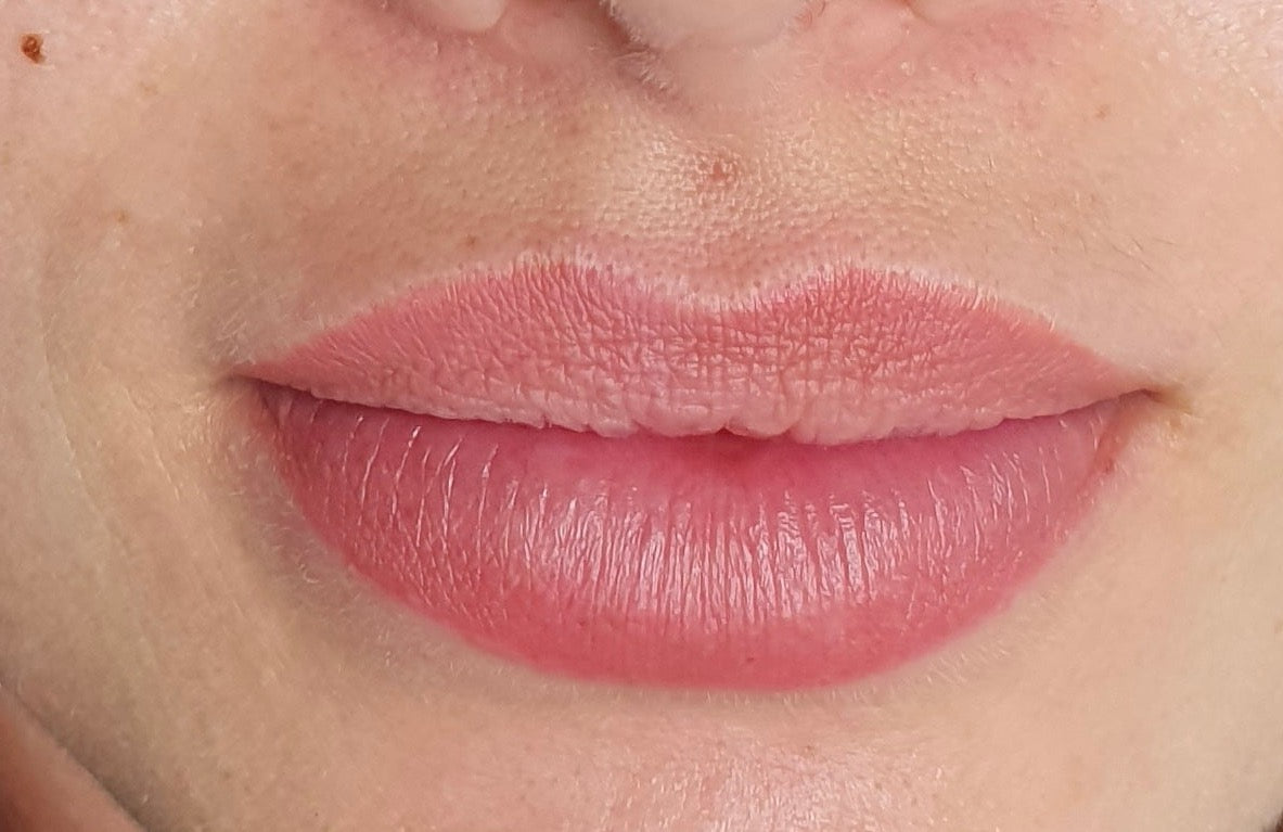 Lippen inklusive 1 Nachbehandlung